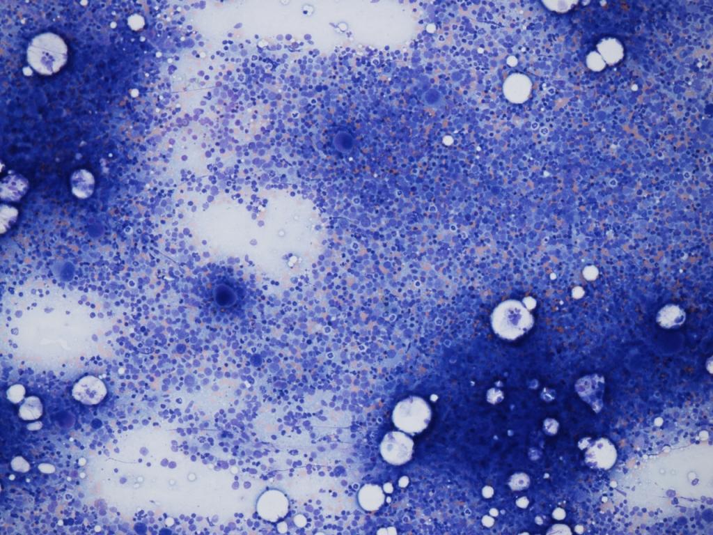 BM asp hypercellular 10x